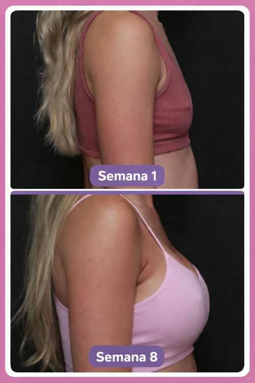 Breast Lifting Mask™ | Mascarilla Reafirmante de Busto con Extractos Naturales